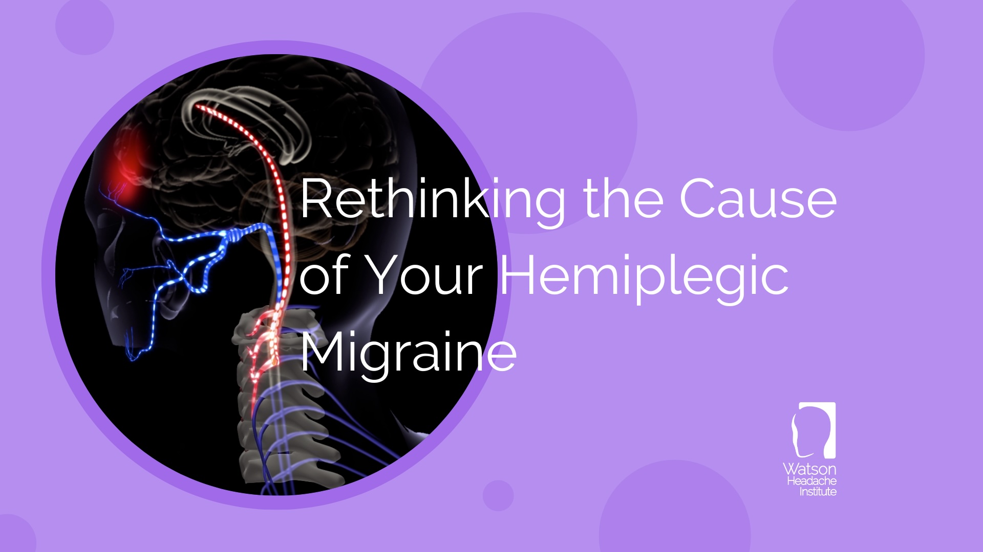 Hemiplegic Migraine