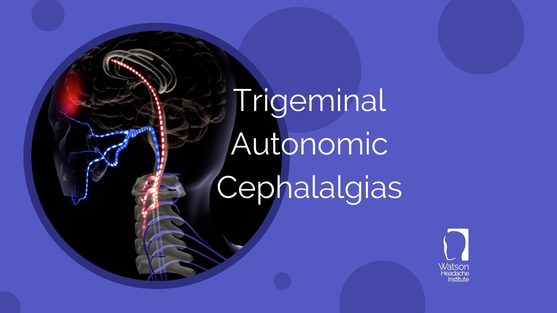 Commentary - Trigeminal Autonomic Cephalalgias
